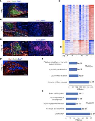 Distinct defects in early innate and late adaptive immune responses typify impaired fracture healing in diet-induced obesity